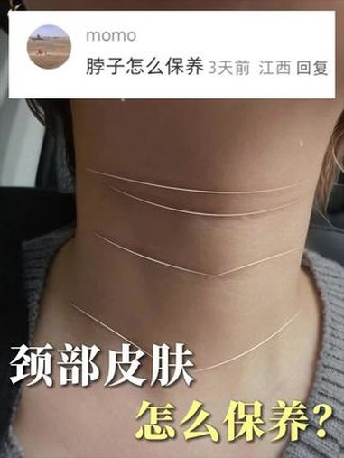 颈部保养指南 颈纹 鸡皮肤 紧致 抗衰 八大处王克明