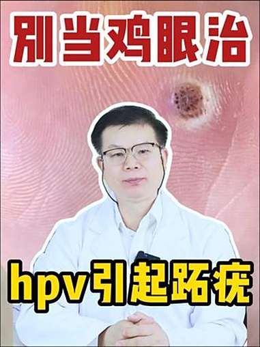 这可不是鸡眼，别乱治，当心越长越多！跖疣 HPV 科普 健康科普 传染