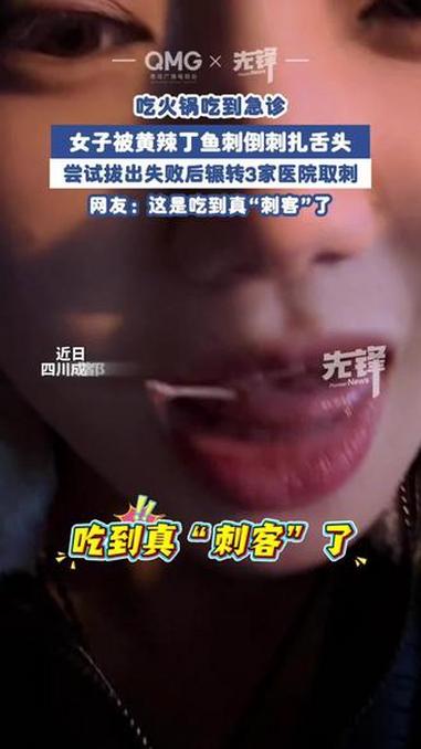 女子被4cm鱼刺卡舌连跑3家医院 黄辣丁才是真的火锅刺客 @独美