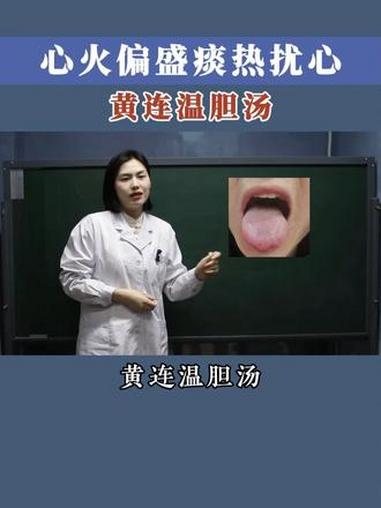 心火偏盛痰热扰心,黄连温胆汤 中医韩曼主任 抖出健康知识宝藏 印象最深的门诊故事