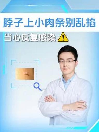 脖子上长小肉条别乱掐,教你一个正确处理方法 丝状疣 咪喹莫特乳膏 hpv感染 疣