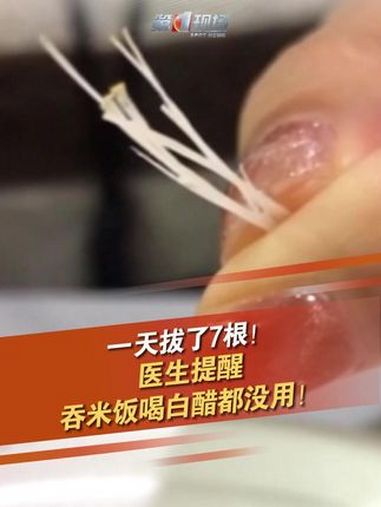 春节阖家团圆之际,大家免不了吃上一道寓意“年年有余”的鱼。随之而来的是小朋友被鱼刺卡喉的情