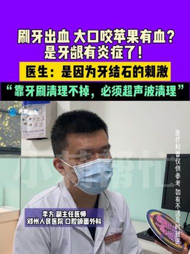 8月21日(发布),河南郑州,刷牙出血,大口咬苹果有血?是牙龈有炎症了!医生:是因为牙结石
