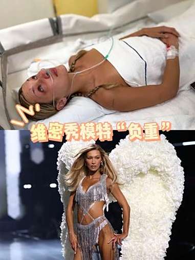 维密秀模特“负重” 9月份还在抵抗疾病,10月就在维密秀上被安排了一个50多斤重的翅膀……