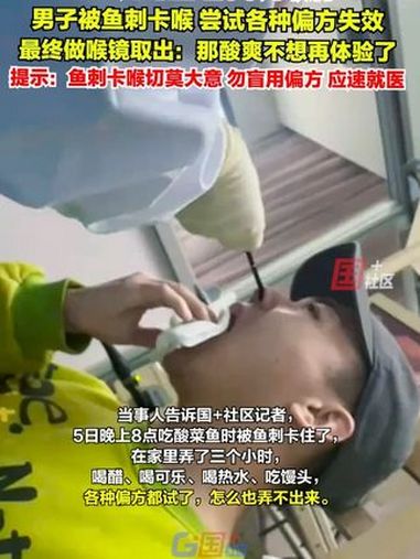 4月6日,上海。男子被鱼刺卡喉,尝试各种偏方无果,最终做喉镜取出:再也不敢吃鱼了,这次真有