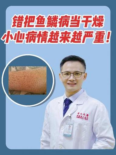 错把鱼鳞病当干燥，小心病情越来越严重！医学科普 鱼鳞病