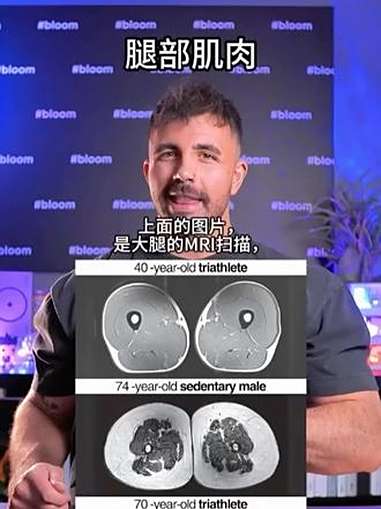 腿部肌肉