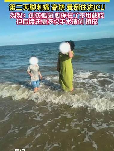 福建厦门:6岁男孩在海边赤脚玩耍,因踩到死鱼,直接住进了 ICU!母亲:是感染了创伤弧菌,