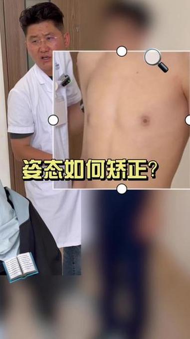 姿态如何矫正 #鸡胸 #肋骨外翻 #漏斗胸 #健康科普破圈计划 #抖出健康知识宝藏