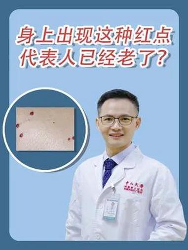 你身上有这种小红点吗?有人说身上出现这种红点,代表人已经老了?医学科普 知识分享 樱桃状血