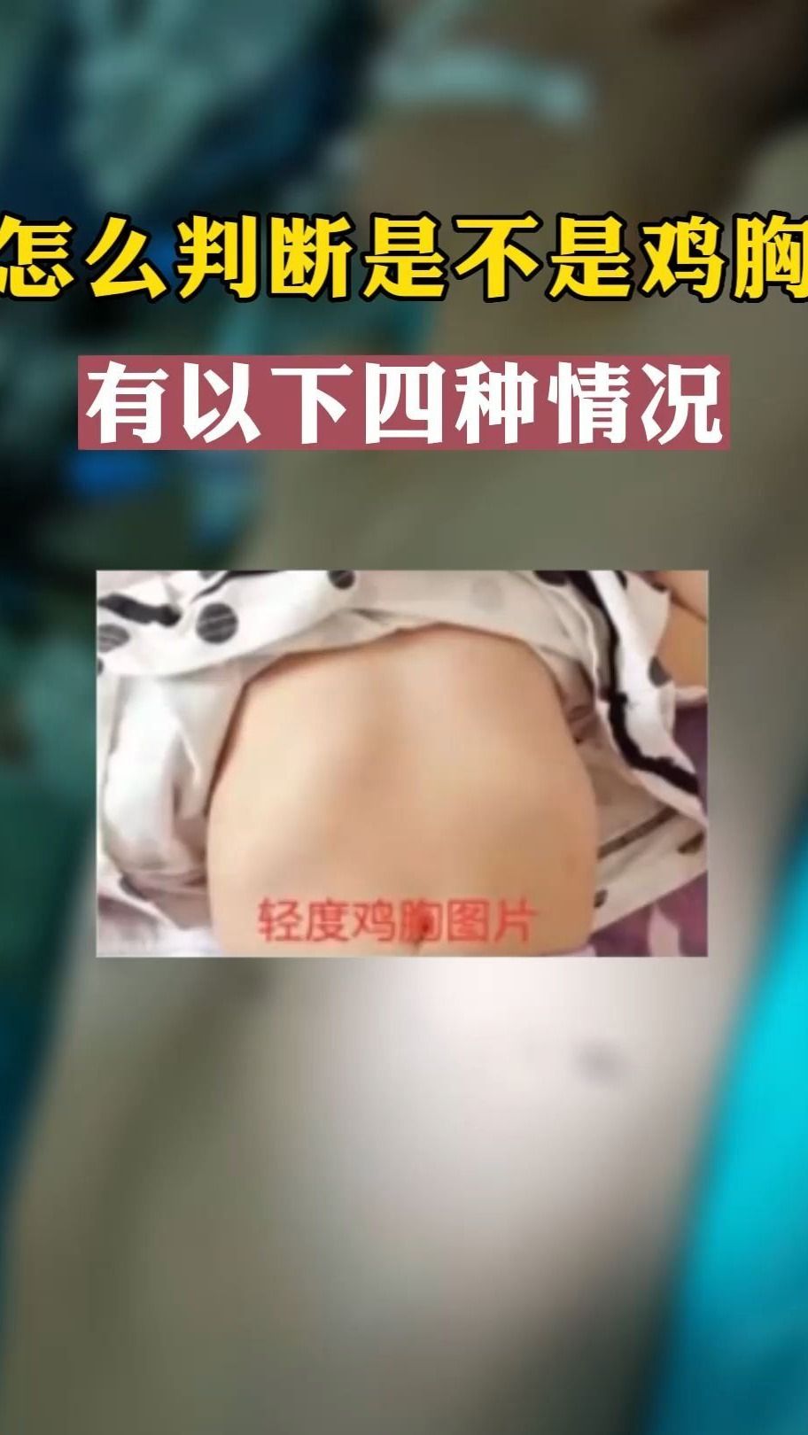 怎么判断是不是鸡胸?