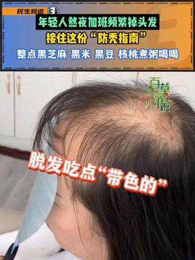 年轻人被迫熬夜加班频繁掉头发,接住这份“防秃指南”,整点黑芝麻黑米黑豆核桃煮粥喝喝。养生 