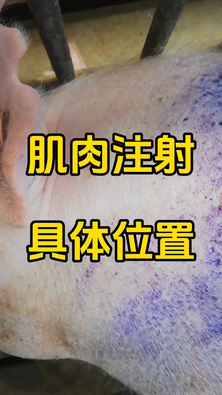 肌注具体位置