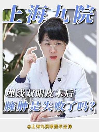 埋线双眼皮术后臃肿 是失败了吗 #上海九院王梓 #自然双眼皮 #埋线双眼皮 #双眼皮术后 