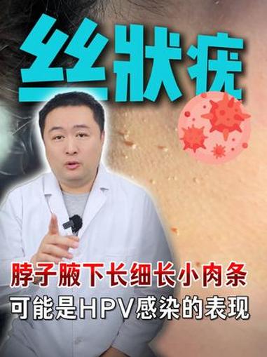 脖子、腋下长小肉条，当心HPV病毒感染！#丝状疣 #HPV #脖子上的小肉粒 #健康科普 