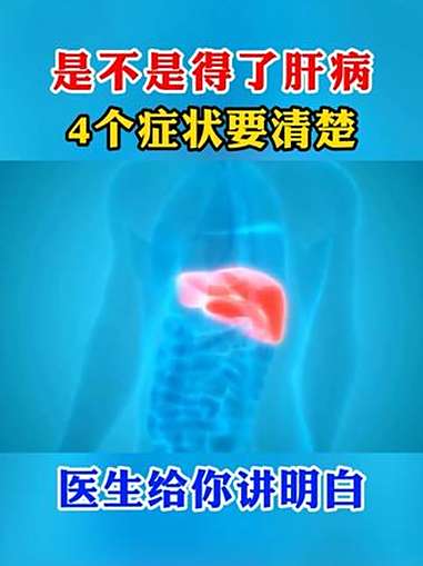 是不是得了肝病,4个症状要清楚,医生给你讲明白 肝病 中医 医学科普
