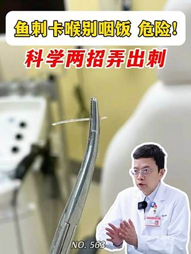 鱼刺卡喉别再咽饭喝醋了,很危险!试试这两招 鱼刺 鱼刺卡喉 鱼刺卡喉怎么办 抖出健康知识宝