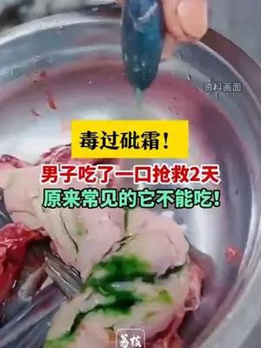 毒过砒霜!男子吃了一口抢救2天。医生特别强调,鱼胆不能吃,最严重可致死,目前没有特效解毒药