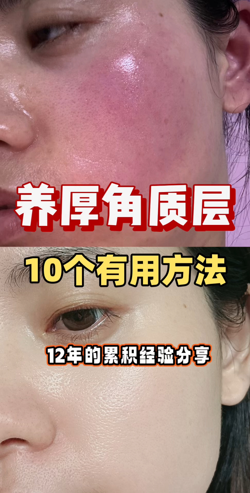 增厚角质层的10个有效方法