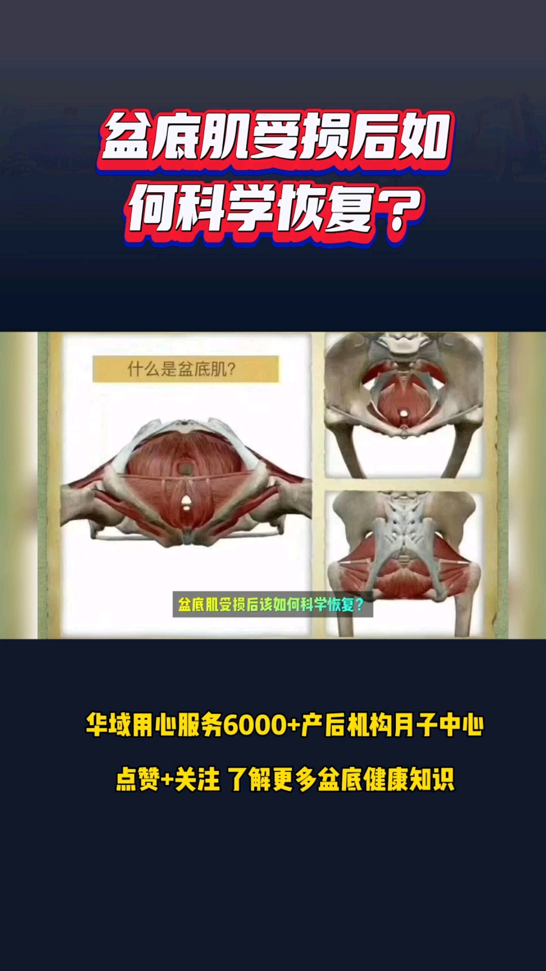 盆底肌受损后如何科学恢复?