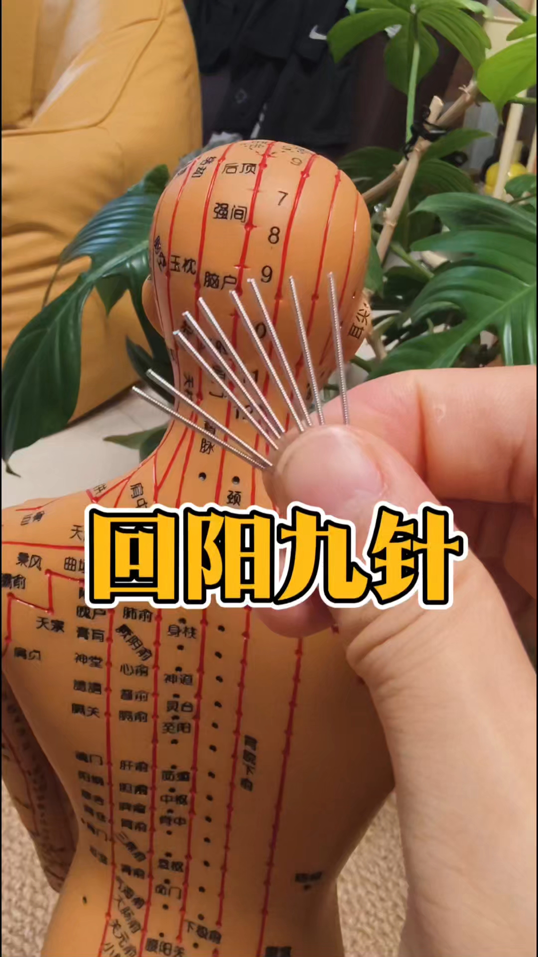 回阳九针