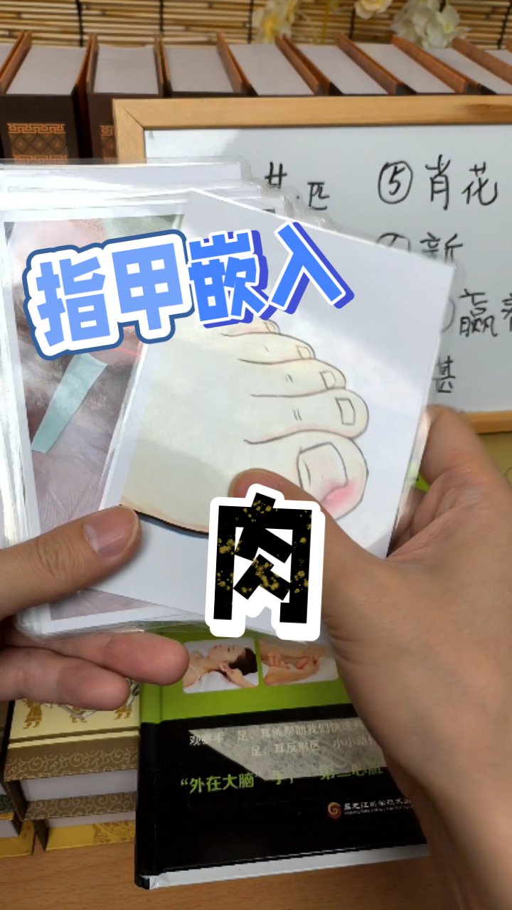 指甲长肉里?脚上手上都头疼