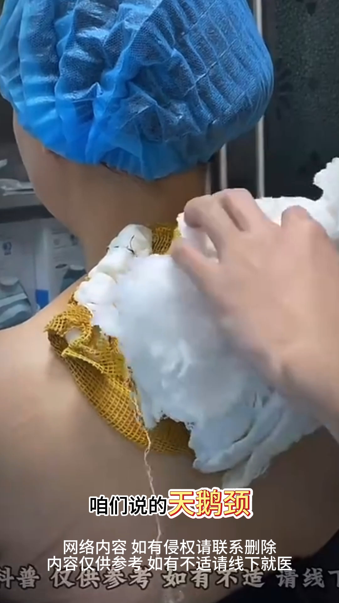 想拥有天鹅颈?得先知道影响天鹅颈的是什么?!