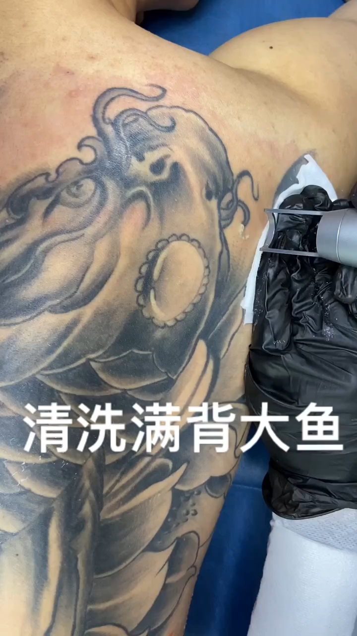 龙虎堂专业洗纹身#洗纹身#