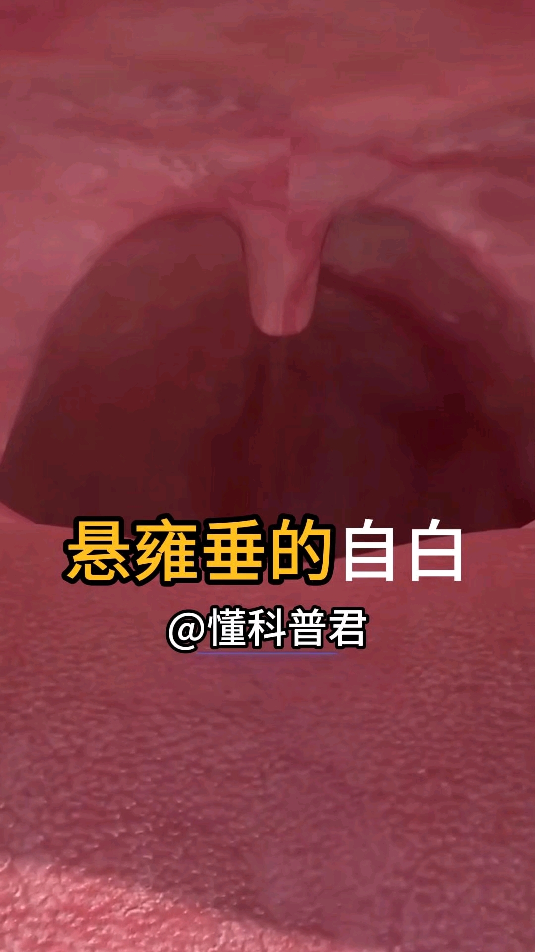 我是你的悬雍垂,你懂我吗?