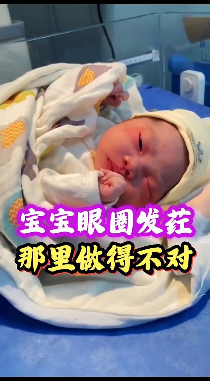 刚出生宝宝眼圈发红,那里做的不对呢
