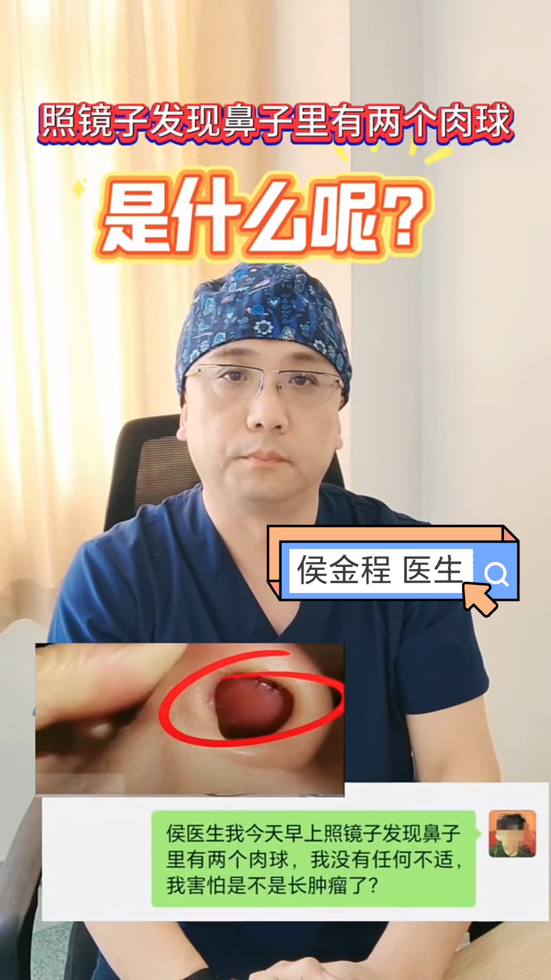 照镜子发现鼻内有两个肉球,是什么呢?