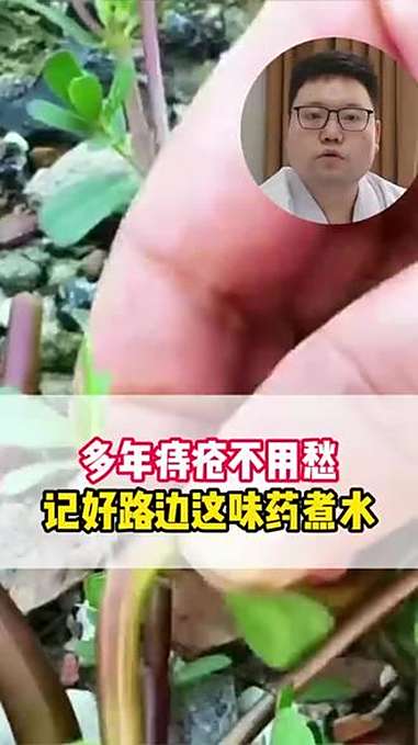多年痔疮不用愁,记好路边这味药煮水 痔疮 肛肠科 中医 中医科普 抖出健康知识宝藏