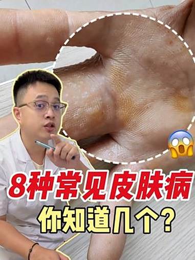 身上常见的8种皮肤病,医生帮你应对!常见皮肤病 皮肤病表现 毛囊炎 鸡皮肤 健康科普有真知