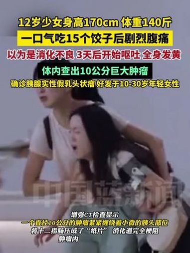 12岁少女身高170cm,体重140斤,一口气吃15个饺子后剧烈腹痛,以为是消化不良没重视