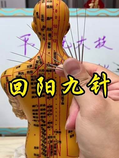 回阳九针 古代神医的“还魂针”!每日分享 回阳九针 传承中医文化 飞针 针灸学习