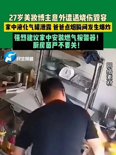 5月27日 辽宁沈阳 27岁美妆博主意外遭遇烧伤毁容。家中液化气罐泄漏,爸爸点烟瞬间发生爆