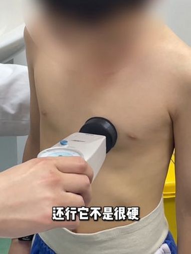门诊日常 不对称的鸡胸通常是左右胸骨发育速度不均导致的,家长们日常生活中要注意孩子的运动锻