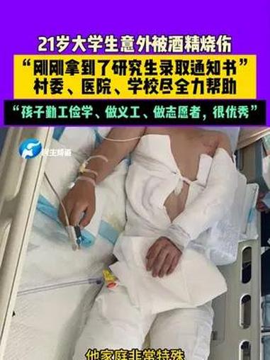 河南新乡,21岁大学生意外被酒精烧伤,“刚刚拿到了研究生录取通知书”,村委、医院、学校尽全