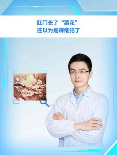 肛门长了“菜花”,还以为是痔疮犯了 HPV感染 尖锐湿疣 派特灵 守护派计划