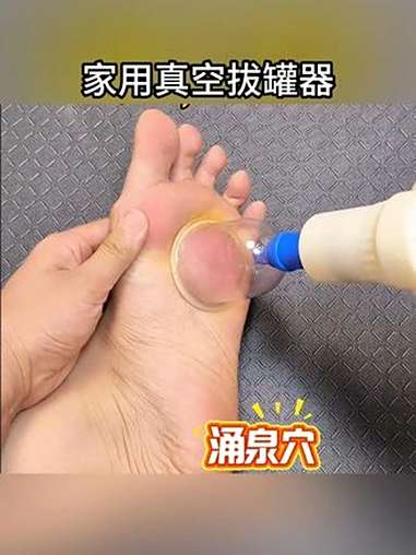 拔罐器 真空拔罐器 家用拔罐器 拔罐 拔罐养生