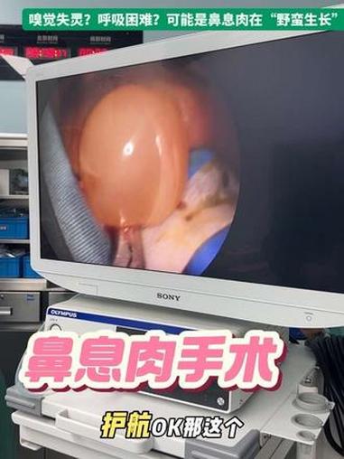 鼻子“堵车”了？这可能不是感冒，是鼻息肉！嗅觉失灵？呼吸困难？可能是鼻息肉在“野蛮生长” 