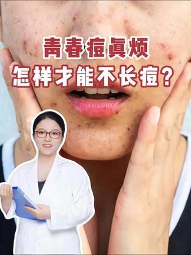 怎样才能不长青春痘！#青春痘 #痘痘 #抖出健康知识宝藏 #医疗健康创作训练营 #我的年度