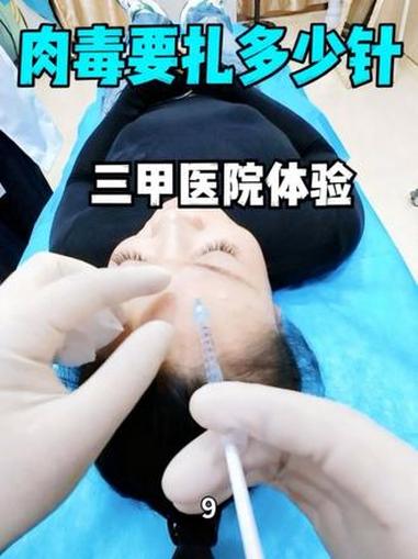 全脸肉毒要扎多少针？听说视频第二次发会有大流量？是真的吗？那我们再发一次这个视频，看看能不
