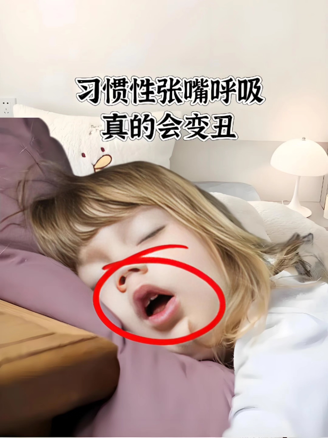 张嘴巴睡觉会变丑