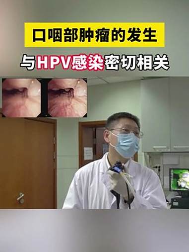 口咽癌 hpv感染 医学科普 倪晓光