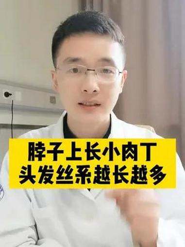 脖子上长小肉丁,不要放松警惕 丝状疣