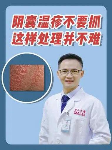 阴囊湿疹不要抓,这样处理并不难 医学科普 湿疹 干货分享