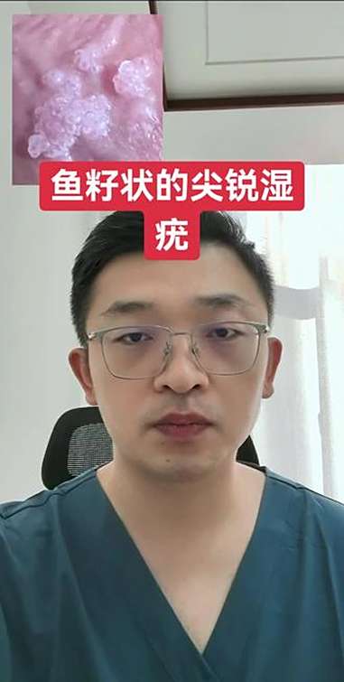 鱼籽状的尖锐湿疣 医学科普 医疗健康创作训练营 抖出健康知识宝藏 健康科普不基础 尖锐湿疣