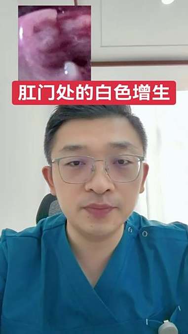 肛门处的白色增生 夫妻 医学科普 hpv 抖出健康知识宝藏 肛肠