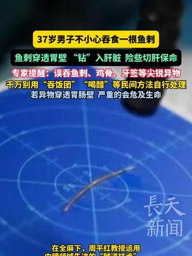 37岁男子不小心吞食一根鱼刺,鱼刺穿透胃壁 “钻”入肝脏,险些切肝保命,专家提醒:误吞鱼刺